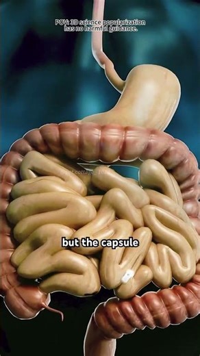 Capsule Endoscopy (3D Animation)