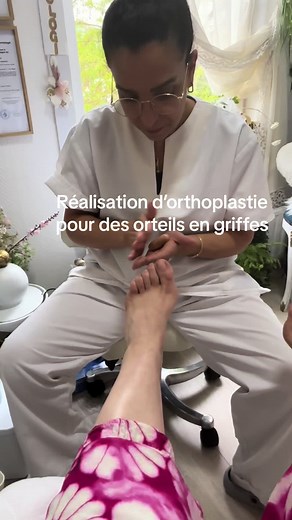 #Orthoplastie #Podologie médicale pédicure médicale #orteil en griffe #Orthese la sousdiaphisaire orteils en griffes