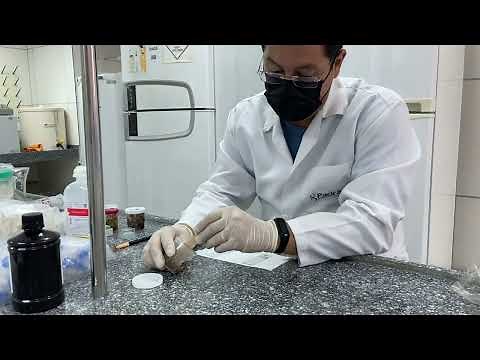 Técnica de exame microscópio de fezes, direto à fresco e direto com Lugol na análise parasitológica