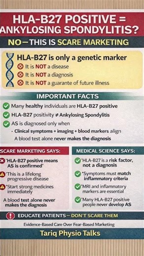 HLA B27 positive & Ankyslosing Spondylitis #arthritis #pain