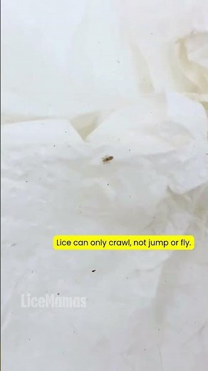 Lice can only crawl, they can’t jump or fly. #licetok #lice