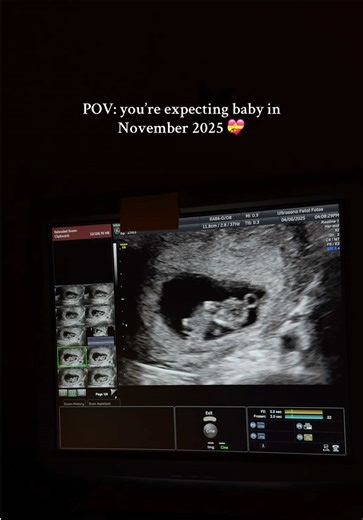 9 Weeks Pregnancy Ultrasound Journey in 2D