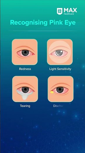 Conjunctivitis: Symptoms and Prevention