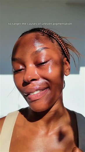 how to fade dark spots + hyperpigmentation