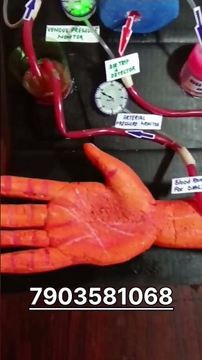 dialysis Working Model #biologymodel #workingmodel #dialysis #hemodialysis #workingmodel