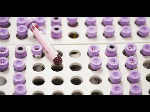 The Ultimate Guide to Cholesterol Tests: New Guidelines for Heart Health