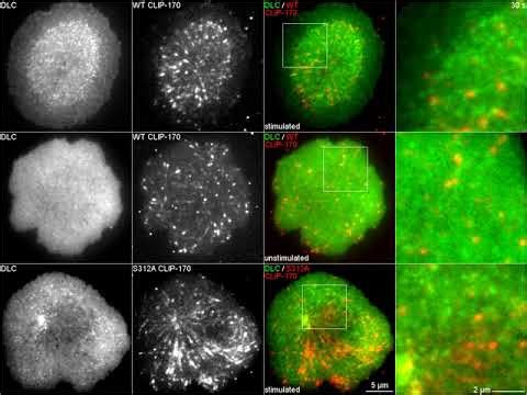 免疫細胞活性化に重要な中心体移動の謎解明 - Tokyo Tech Research