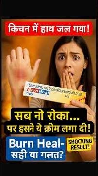 🔥Burn Heal Cream: जलने पर मिनटों में राहत! सही तरीका, Dose & Side Effects | बहुत लोग गलत लगाते हैं!