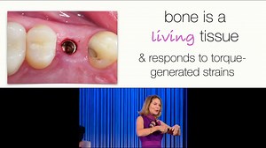 Learn more about factors influencing osseointegration in Dr. Helms' free video lectue. | Foundation for Oral Rehabilitation