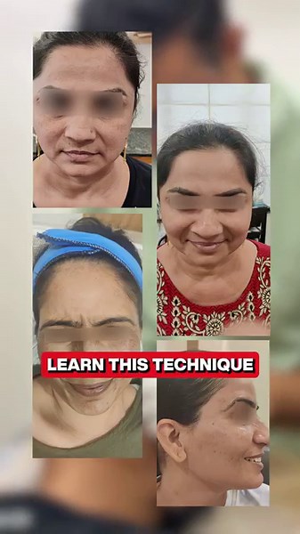 Master Botox in Just One Day!Want to level up your aesthetic game?