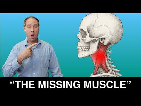 The #1 Muscle You Must Strengthen for Cervicogenic Headache Relief