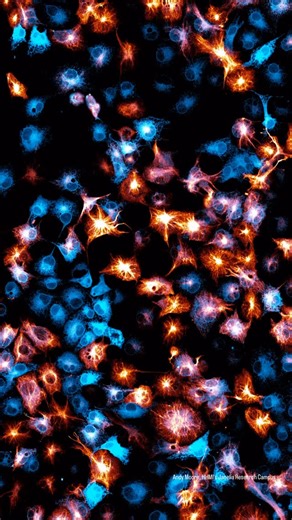 Tomasz Grzywa on Instagram: "A little cell dance 😍🔬 This time-lapse video shows living cells in a culture dish, revealing the dynamic, ever-moving inner life of a cell. You can see the endoplasmic reticulum in blue and the cytoskeletal network in orange, shifting and reshaping as the cells explore their space. How many dividing cells can you spot? Credits: Andy Moore, HHMI’s Janelia Research Campus, HHMI #scientist #science #laboratory #microscope #biology"