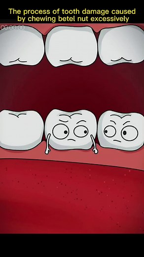 The Dangers of Betel Nut Chewing: Impact on Teeth