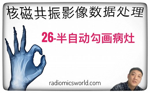 【核磁共振影像数据处理】| ITK-SNAP半自动勾画病灶/感兴趣区全流程通俗讲解