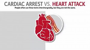 25K views · 19 reactions | Sudden cardiac arrest and heart attack are often confused, but they are not the same.變 According to the American Heart Association: ➡️ Cardiac Arrest occurs when the heart unexpectedly malfunctions and stops beating. ➡️ Heart attack happens when blood flow to the heart is blocked. Knowing the difference can save lives. Learn more here: https://bit.ly/3WwK4Zb #LifeBridgeHealth #AmericanHeartMonth #CardiacArrest #HeartAttack | LifeBridge Health | Facebook