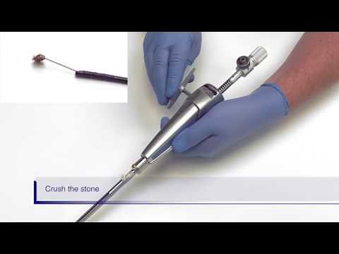 LithoCrushV Rotatable In-Service