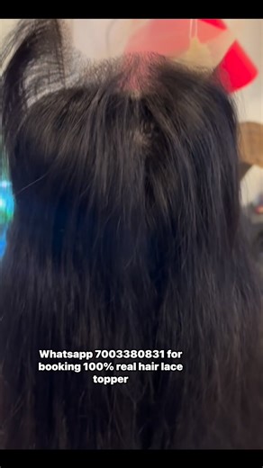Whatsapp 7003380831 for booking 100% real hair lace topper #realhair #resedinnghairlinetopper #frontlesstopper #fbviralpost2026シ #highlightseveryone #fbyシvideo #hdtopper #humanhairtopper #filmmaking #bangstopper | PINK BLOW