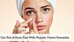 Get Rid of Acne Fast With These Popular Remedies