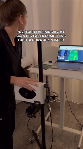 Your bloodwork came back “normal” - but your body is still feels like something’s off. Here’s what traditional labs often miss: inflammation patterns, circulation issues, and metabolic changes happening RIGHT NOW in your tissues. Thermography doesn’t wait for bloodwork to catch up. It shows you the thermal signatures of inflammation before they become symptoms you can’t ignore. What this scan reveals: 🔴 Red/hot zones = active inflammation 🔵 Cool areas = circulation problems ⚠️ Asymmetry = your