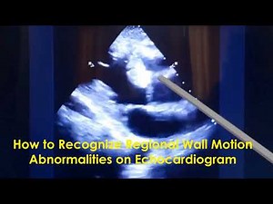 How to Recognize Regional Wall Motion Abnormalities on Echocardiogram