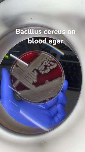 Bacteria colonies😍😍 #lablife #diagnosis #medicallaboratoryscience | Lab life