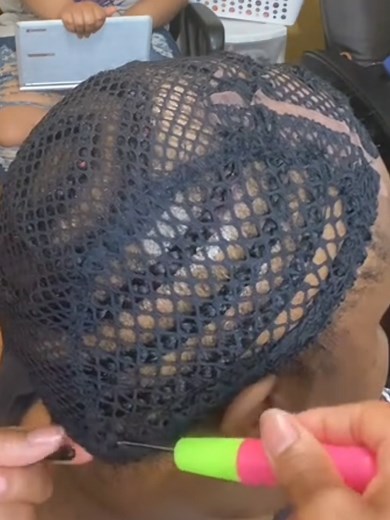 BEST ALOPECIA CROCHET BOX BRAID HAIRSTYLES #hair #hairstyle #hairstyles #hairtutorial #crochet #crochetbraids #crochetbraidstyles #braids #braidstyles #ALOPECIA #alopeciaawareness #alopeciaareata #hairlosssolutions