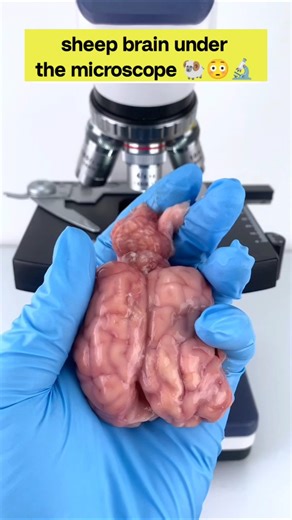 INSANE View Brain Under a Microscope 😳🔬 #shorts #facts #microscope #brain #science #fun