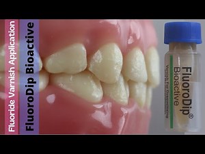 Fluoride Varnish Application  • Video • MEDtube.net