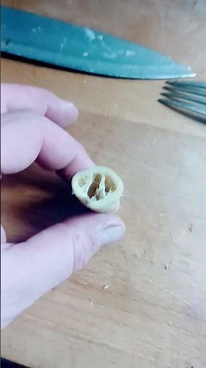 the problem with anal sex