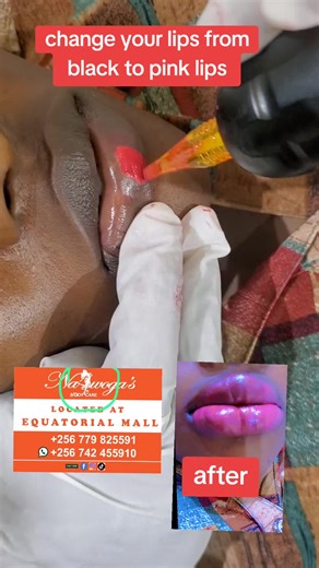 Transform Your Lips: From Black to Pink Shade