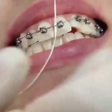 How to use Dental Floss Threader