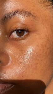 8.7K views · 2.9K reactions | Hey Beautiful ❤️ A gentle reminder of what real skin can look like. Your skin doesn’t need to fit into society’s beauty standards(“glass skin”, “Perfect skin”). You are beautiful just as you are. #acne #acnepositivity #skin #skinpositivity #hormonalacne #texturedskin #fyp #acnecommunity #skincommunity #relatable | Simphiwe Mbatha | Facebook