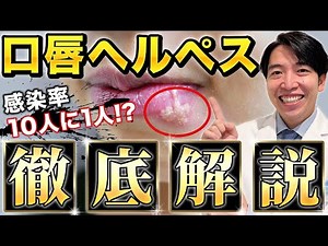 【感染率60%以上⁉︎】「口唇ヘルペス」について医師が解説します（新宿新南口れいわクリニック）