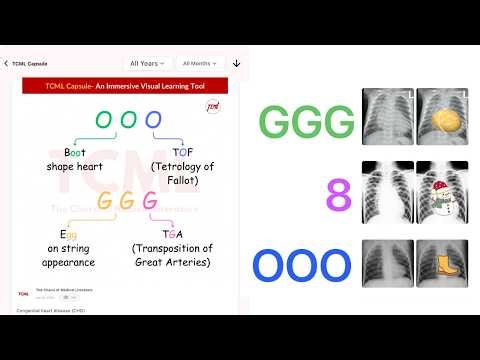 Congenital heart disease | Boot shape heart & Egg on string appearance | TCML Capsule