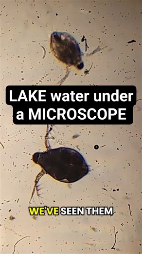 Looking at lake water under a microscope! Pt 8