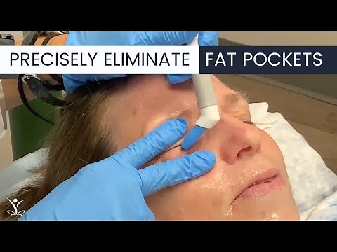 WATCH an Agnes Treatment for Under Eye Bags