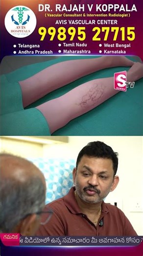 Dr. Rajah V Koppala About Varicose Vein's In Telugu | Avis Hospitals | #shorts #ytshorts