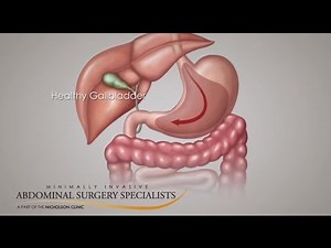 Gallbladder Symptoms