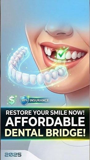 Dental Bridge Costs in 2025: Affordable Tooth Replacement Explained