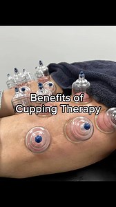 Elevate your performance with cupping therapy! Enhance your flexibility, alleviate muscle tension, and accelerate healing and recovery to take your workouts to the next level! 🚀 • ✨ Book your session today! ✨ • • • #proactiveptperformance #cupping #cuppingtherapy #cuppingforperformance #workoutrecovery #workoutrecoverytips #cuppingbenefits #trainhardrecoverharder #trainhardrecoversmart #cuppingforathletes #recoveryessentials #fitnessrecovery #physio #physicaltherapy #raleighphysicaltherapy #bla