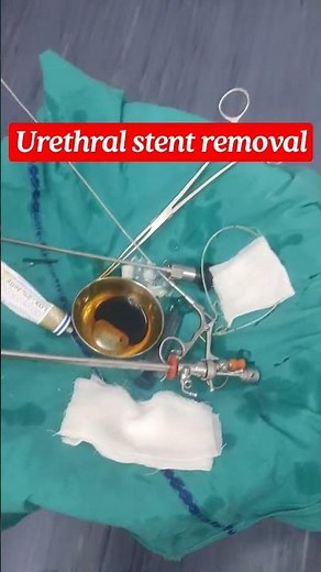 urethral stent removal || Cystoscopy and stent removal #medical #aiims #mbbs #shortvideo #shorts