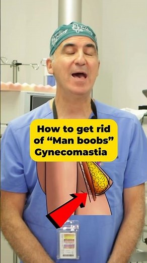 How to get rid of man boobs (Gynecomastia)
