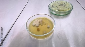 Doctor opens a petri dish in a sterile laboratory cabinet, different colonies of bacteria have grown on the petri dish