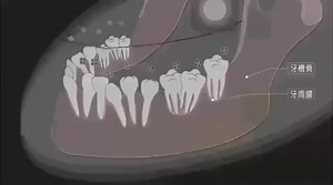 牙齿移动的原理？