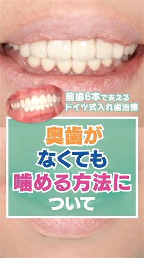 奥歯がなくても噛める方法について
