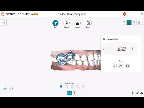 04 DEXIS IS ScanFlow_How to Scan Basic.