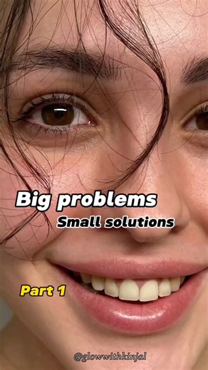 Big problem small solution 🩷☁️#teenroutine #teenbeauty #globalaesthetic