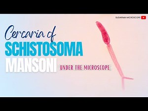 Schistosoma mansoni cercariae under the microscope