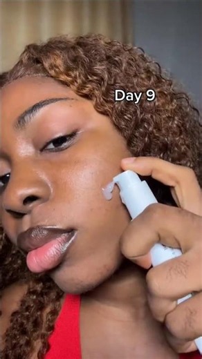 How to get rid of dark spots and hyperpigmentation fast #skincare
