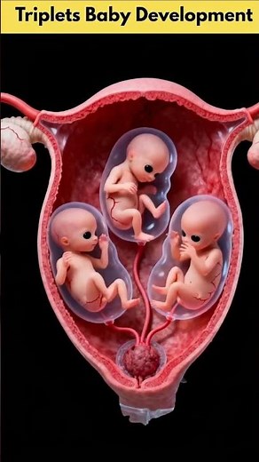 ✨ How triplet babies are developed in the womb ✨